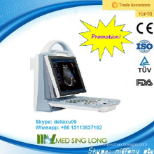 Promotion!!! portable color doppler ultrasound system/ ultrasound machine portable (MSLCU23A)